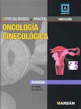 ONCOLOGA GINECOLGICA