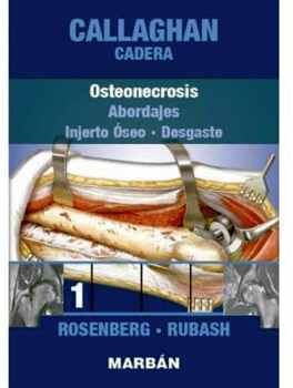 OSTEONECROSIS -INJERTO OSEO- (1)