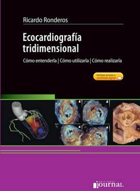 ECOCARDIOGRAFIA TRIDIMENSIONAL