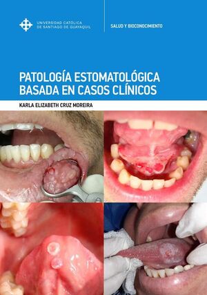 PATOLOGA ESTOMATOLGICA BASADA EN CASOS CLNICOS